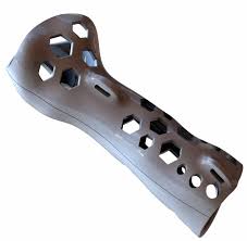 Zac Rubenson - 3d Printed Cast